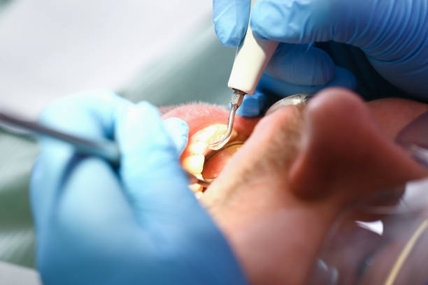 Best Knocked-Out Tooth Emergency  in Knoxvle, IL